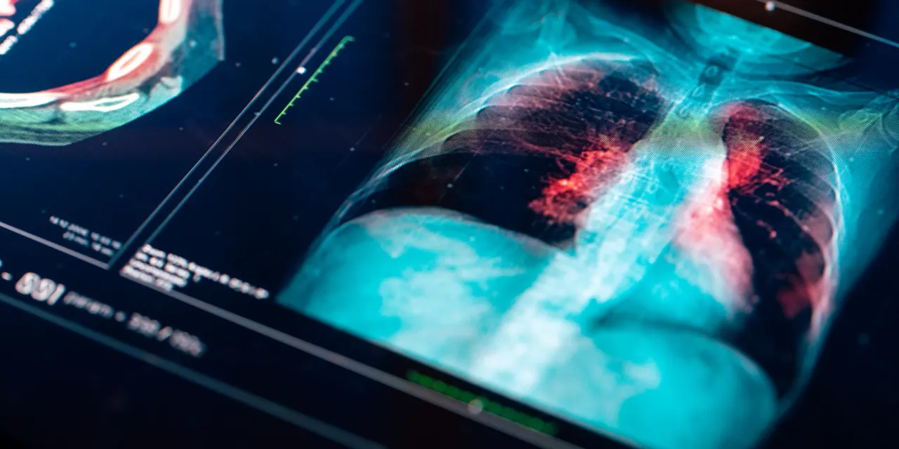 An experimental lung-cancer drug could replace Keytruda one day. But investors aren’t wowed.