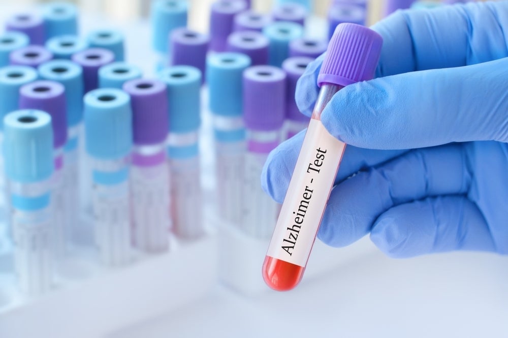 Arrowhead Pharmaceuticals Advances Alzheimer's Drug Push With Promising Early Clinical Results