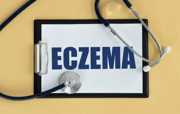 Lilly posts late-stage trial win for Ebglyss in hand-and-foot atopic dermatitis