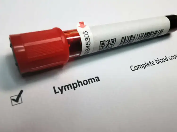 Genmab rises on late-stage trial win for AbbVie-partnered lymphoma therapy