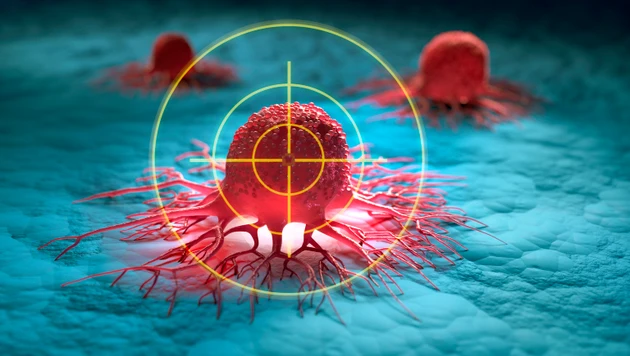 Merck, Eisai face setback in late-stage trial for Keytruda regimen in kidney cancer