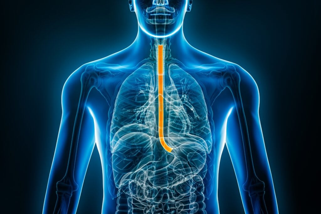 AstraZeneca, Amgen Score Phase 3 Win in Debilitating Swallowing Disease