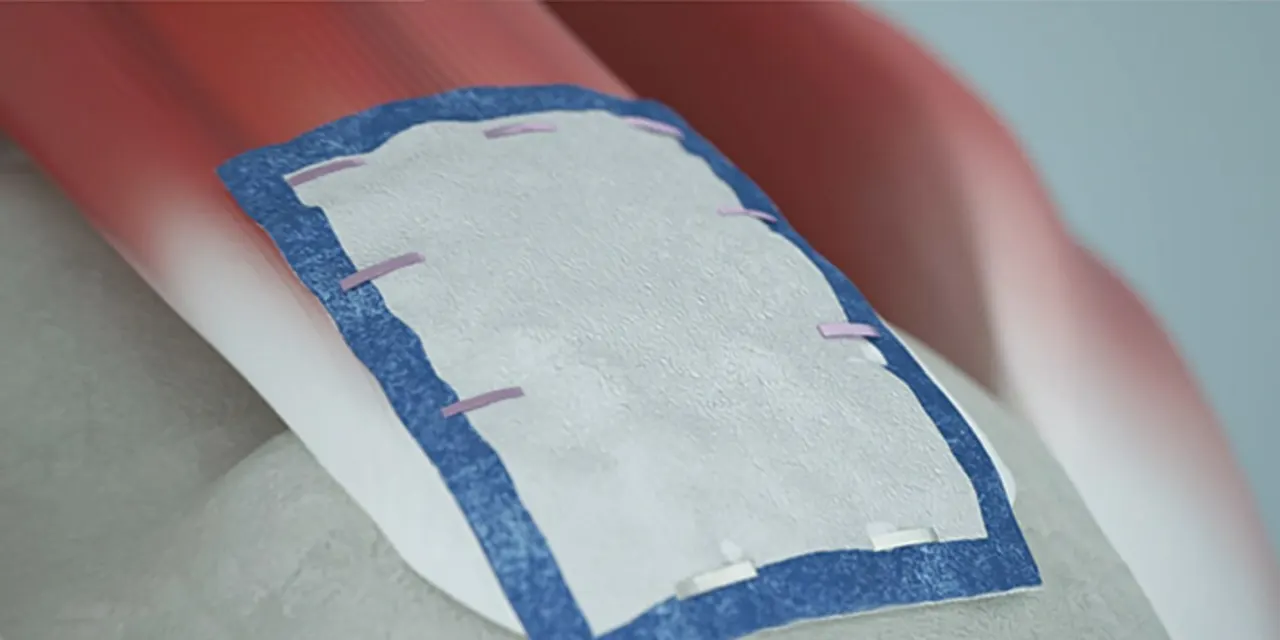 Medical Device Stocks Are Ready to Bounce. Two Names to Buy Now.