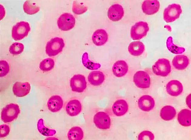 Novartis says novel antimalarial succeeded in late-stage trial