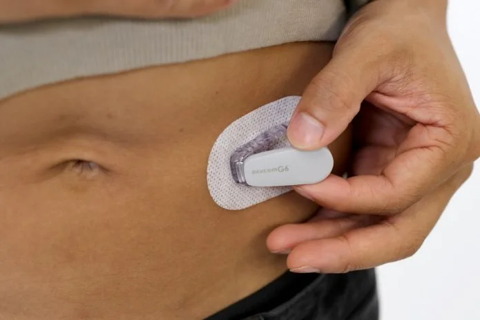 DexCom Faces Short-Term Challenges, But Market Growth Prospects Remain Strong-Analyst