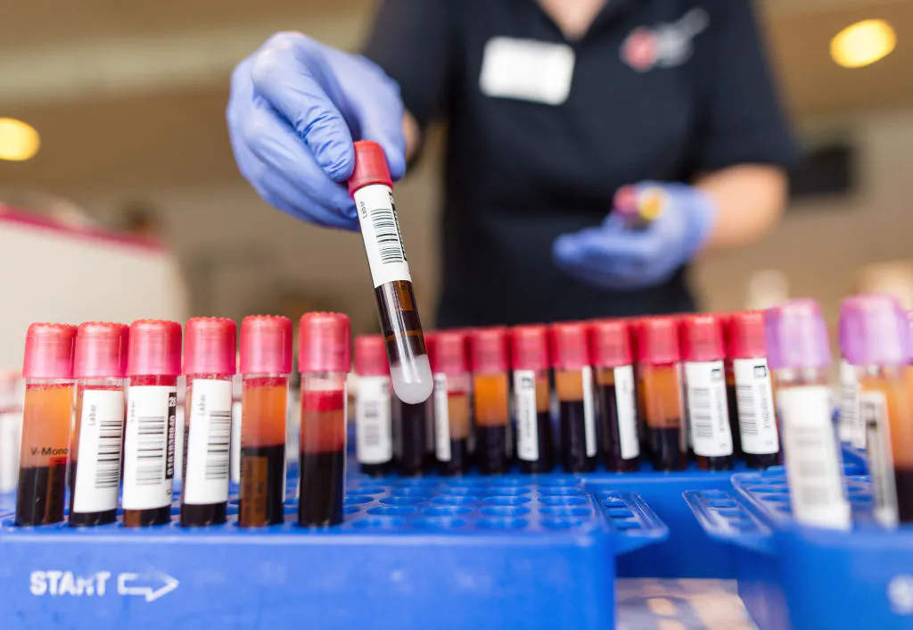 How health startups are turning blood testing and analysis into a sales funnel