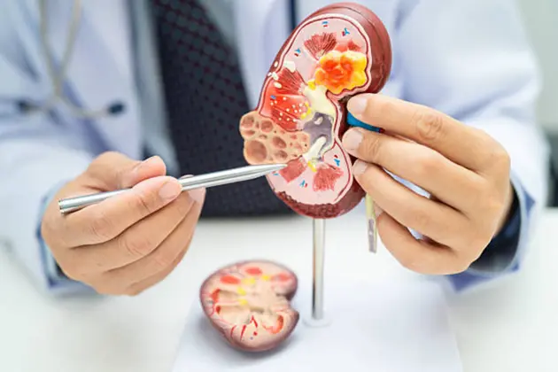 Unicycive seeks to distinguish OLC in crowded CKD hyperphosphatemia market