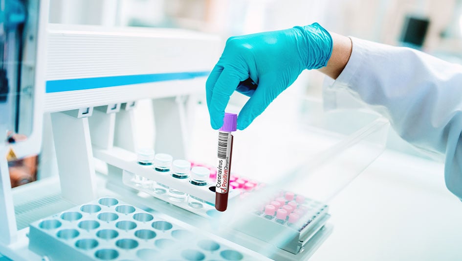 Stryker, Neogenomics Announce CEO Transitions; But One Stock Dives