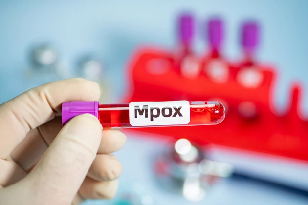 SIGA mpox therapy no longer recommended in EU