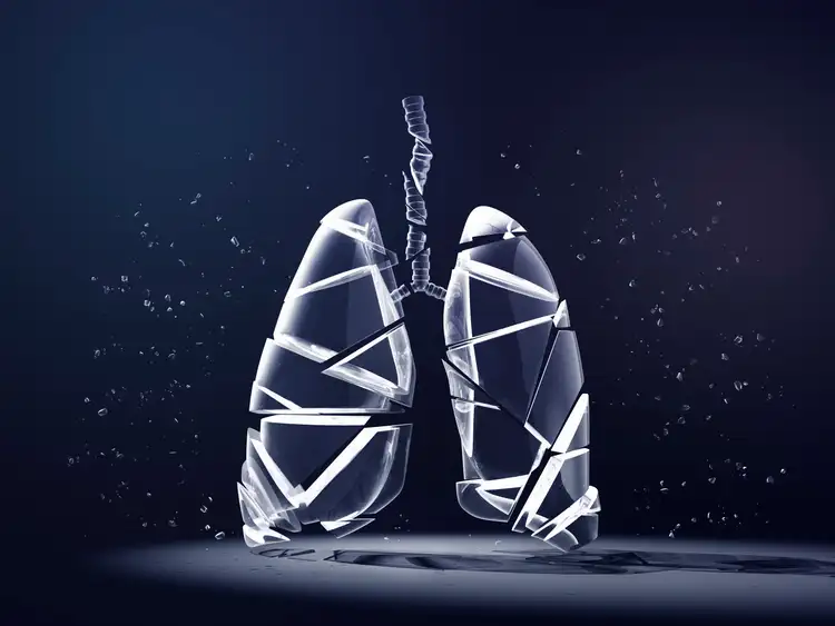 Jazz Pharmaceuticals succeeds in late-stage study of lung cancer treatment