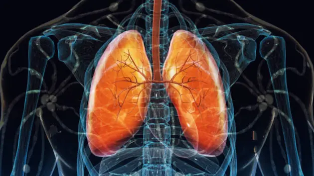 Summit’s ivonescimab cuts death risk by 27% versus Keytruda in lung cancer trial