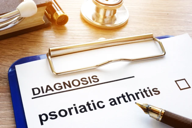 UCB says Bimzelx beat AbbVie’s Skyrizi in psoriatic arthritis trial
